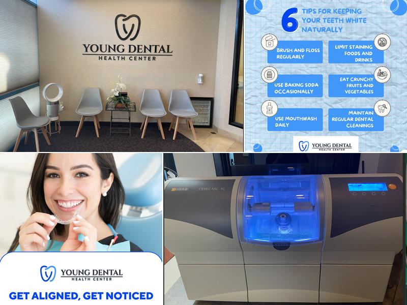 Young Dental Health Center Upland
