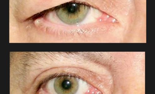 BLURRED LINES SKIN TIGHTENING 5090 State St building A suite 102, Saginaw Michigan 48603