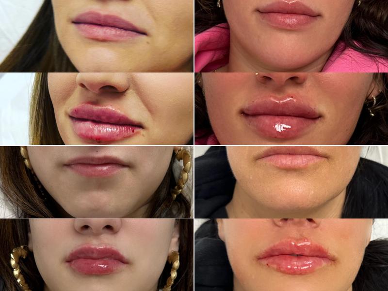 Lummiér Medi Spa LLC