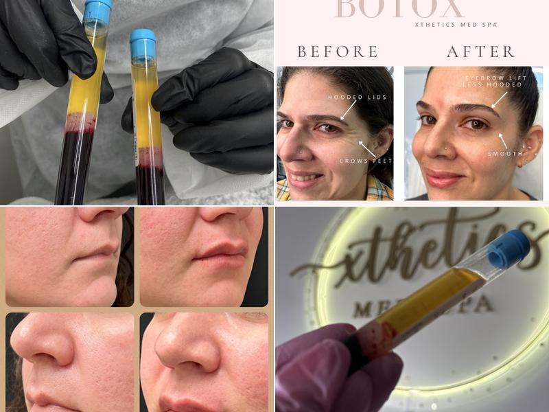 Xthetics Med Spa