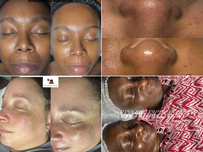 Serving Faces By Ari