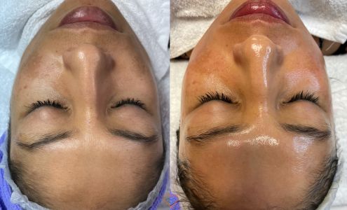 Skinily Medical Aesthetics 10125 N 10th St, McAllen Texas 78504