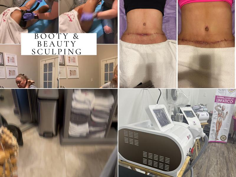 Booty & Beauty Sculping