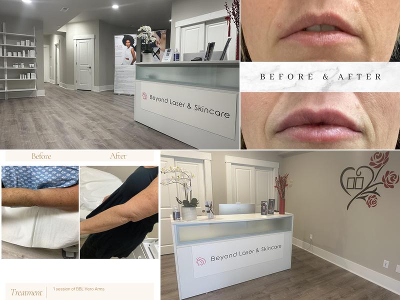 Beyond Laser & Skincare - Sammamish