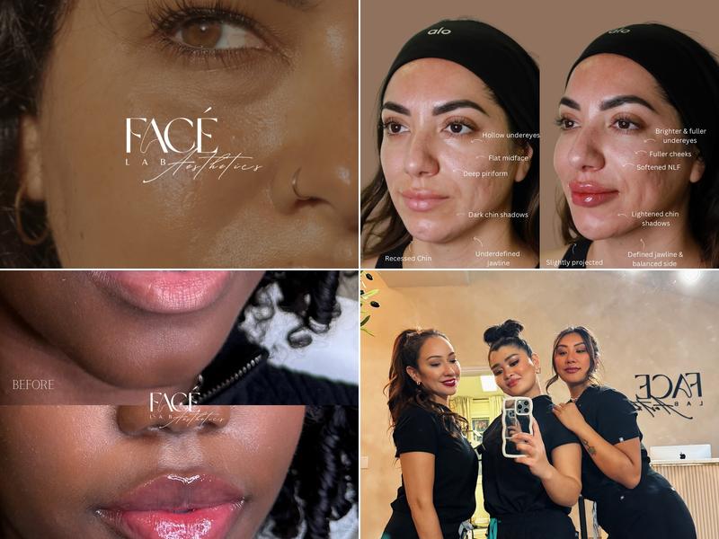 Face Lab Aesthetics