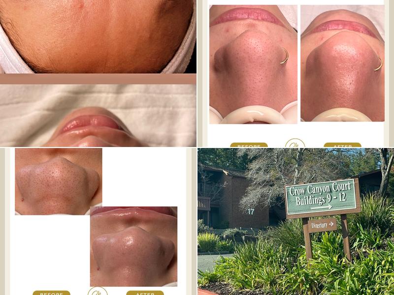 Sayuri Bloom Esthetician