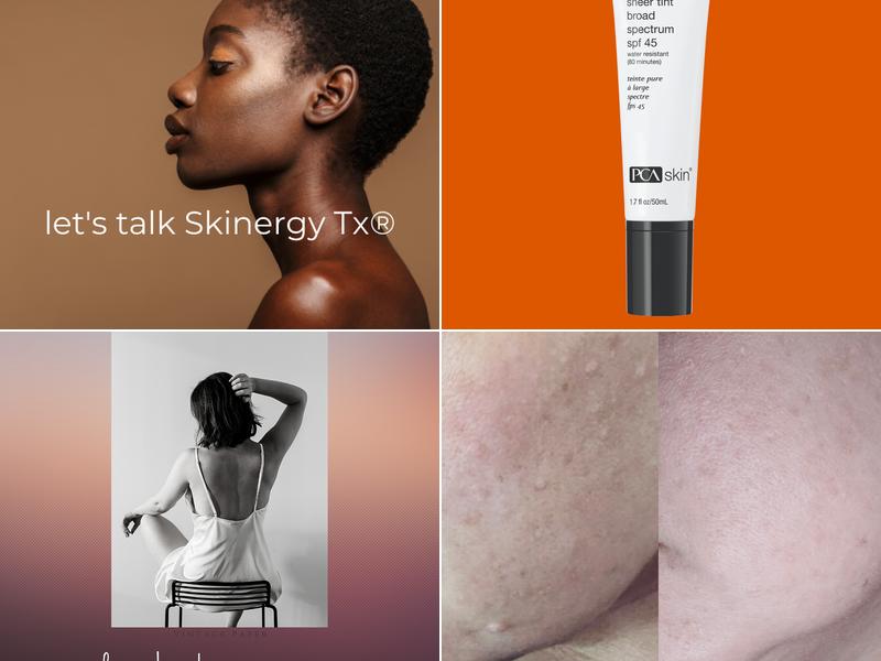Skinergy Simple