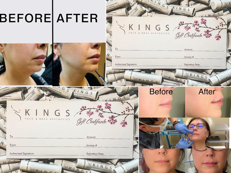 Kings Face and Neck Aesthetics