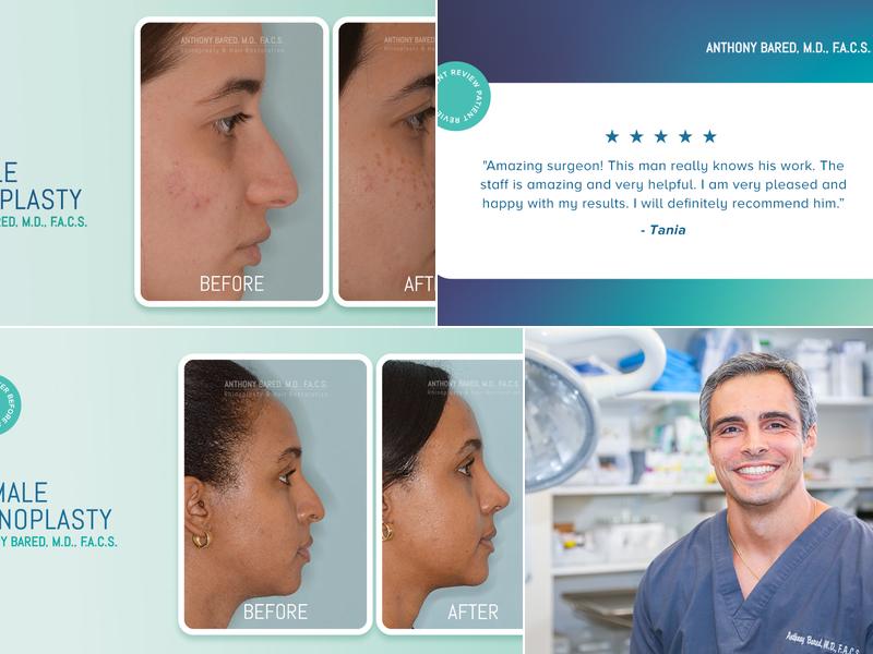 Dr. Anthony Bared, M.D - Facial Plastic Surgeon