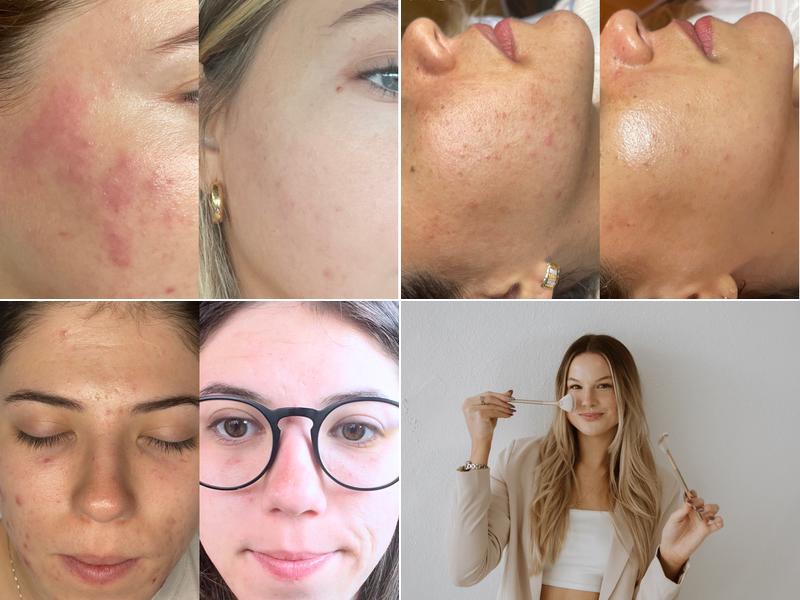 Kylee Skin Aesthetics