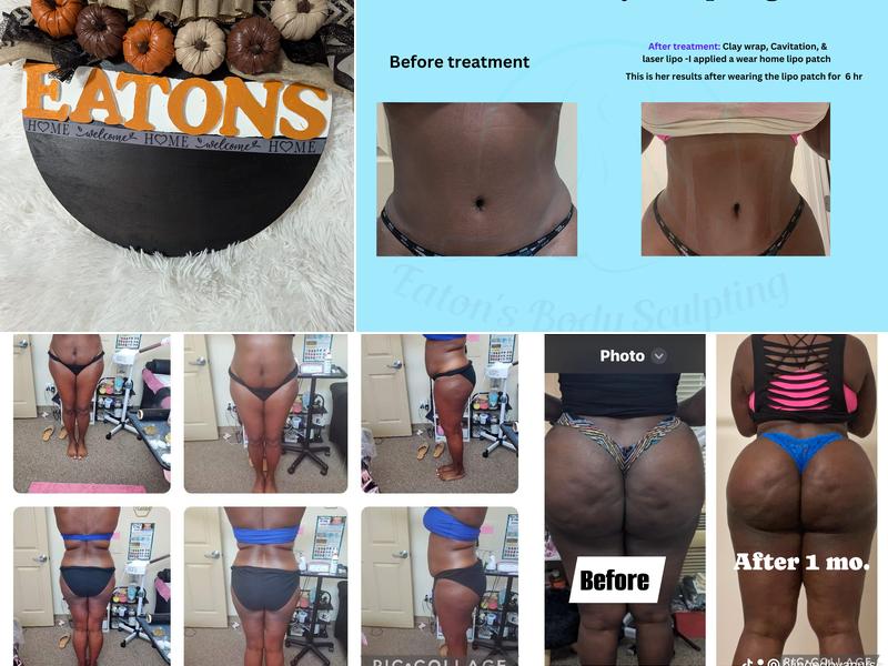 Eaton's Body Sculpting