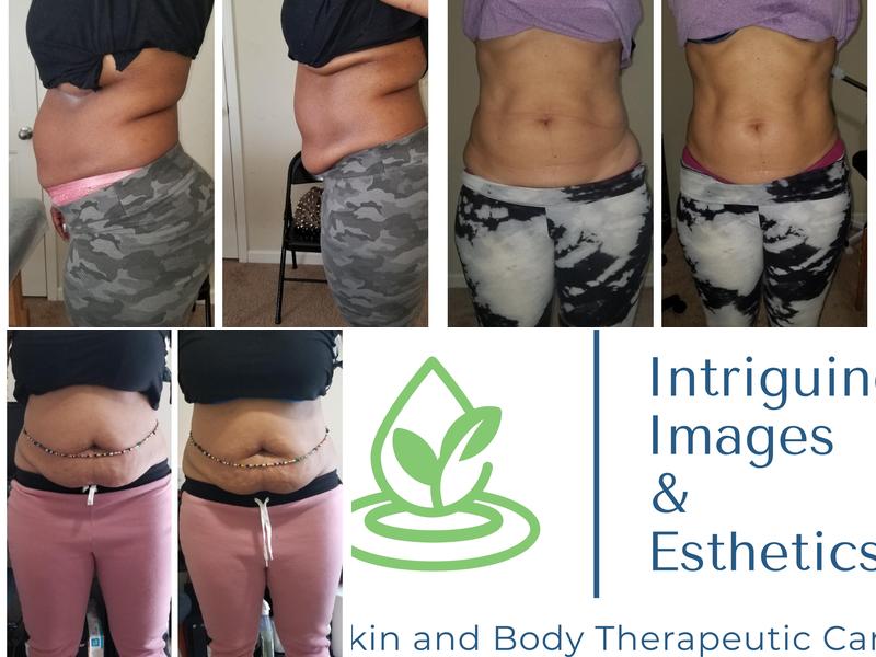 Intriguing Images and Esthetics Salon