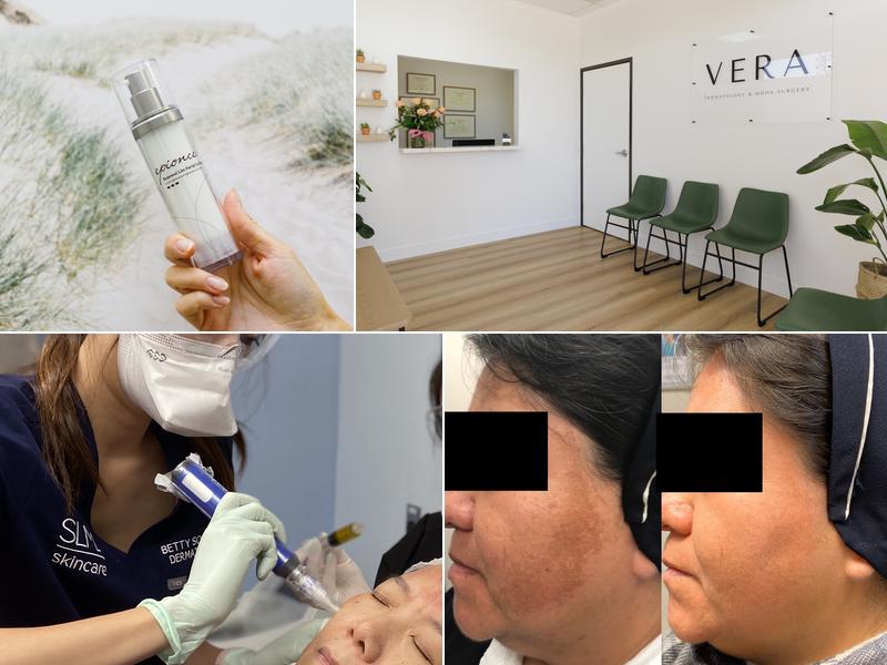 VERA Dermatology