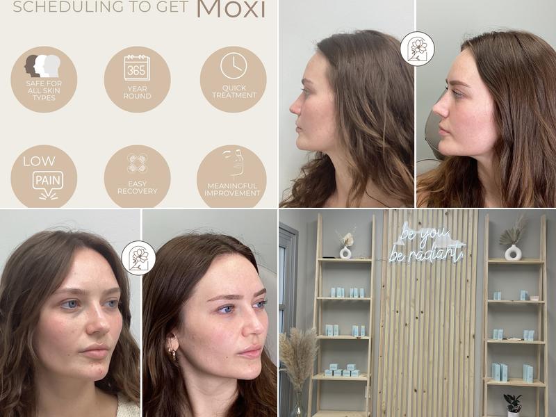 Bare Radiance Aesthetics