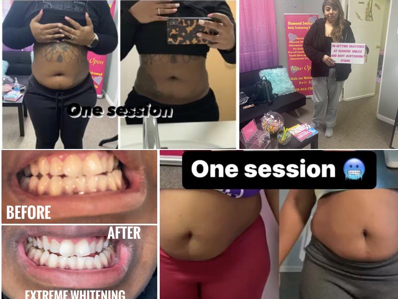 Diamond Smilez & Body Contouring Studio
