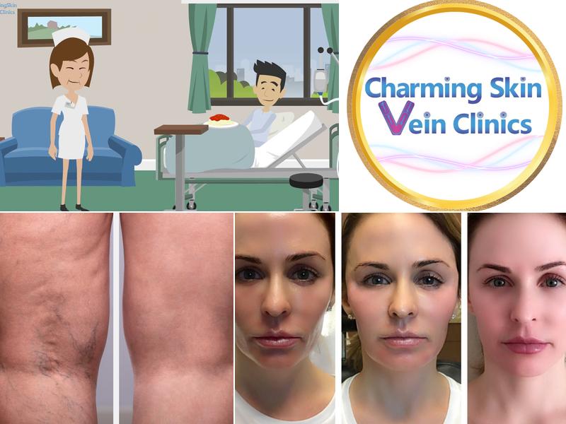 Charming Skin Vein Clinics