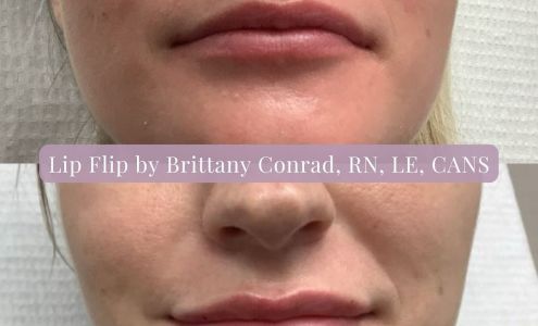 Meridiem DermSpa - Westminster/Mount Airy