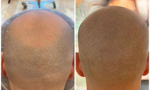 Scalp Micro Mi 10761 S Saginaw St, Grand Blanc Michigan 48439