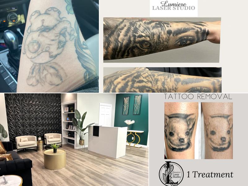 Lumiere Laser Studio