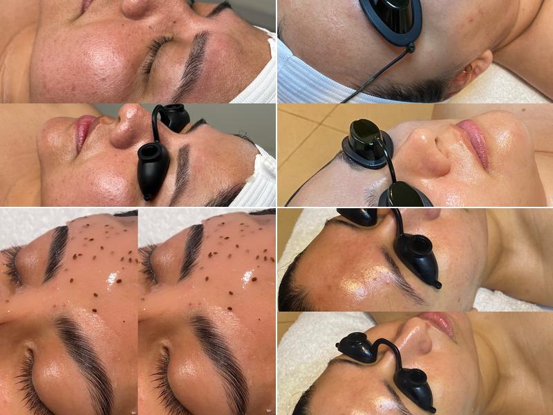 Esthetics With Gabie