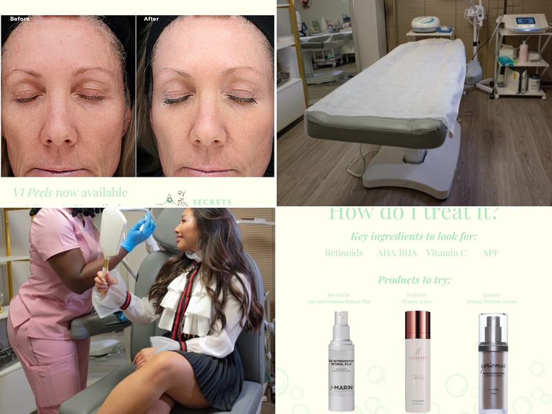 Secrets Unveiled Aesthetics