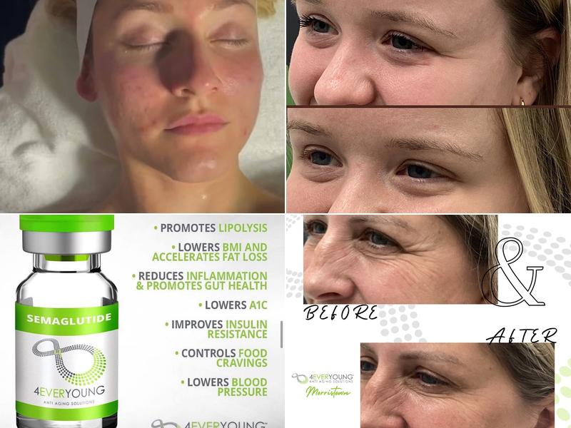 4Ever Young Anti Aging Solutions