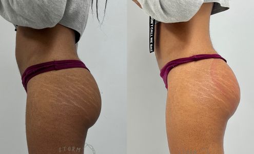 Storm&Glow Esthetics