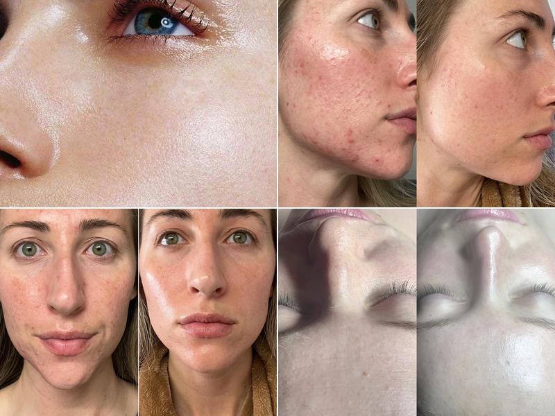 Skin Therapy Skincare and Wellness