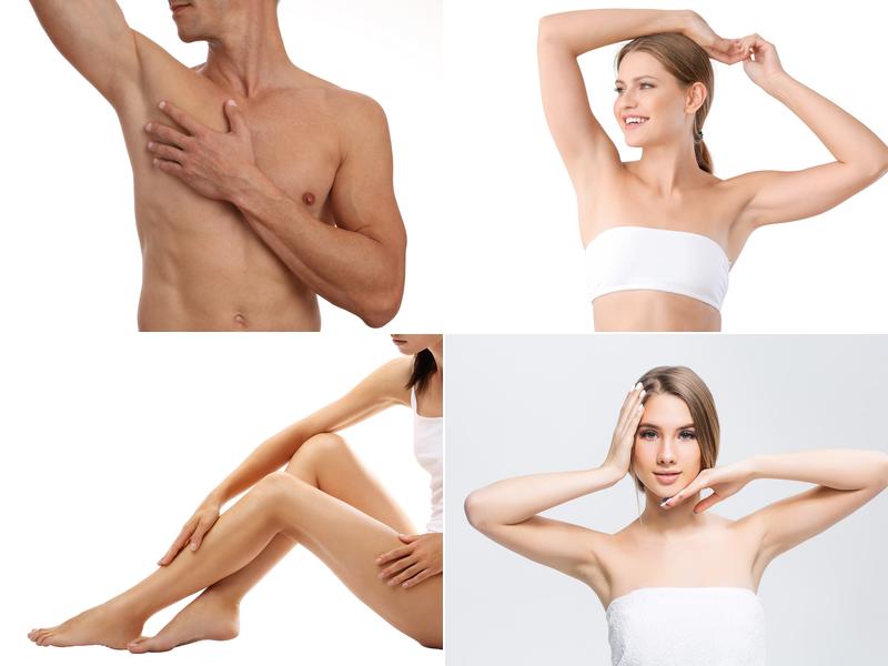 Laser Nurse | Laser Hair Removal NYC