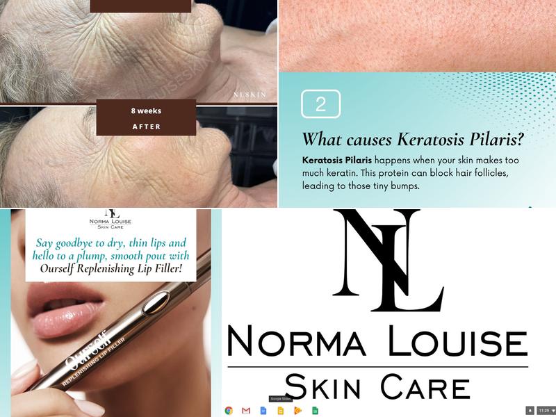 Norma Louise Skin Care