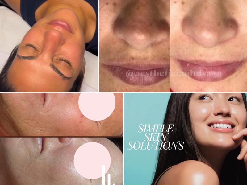 Luisa Lempe Aesthetics