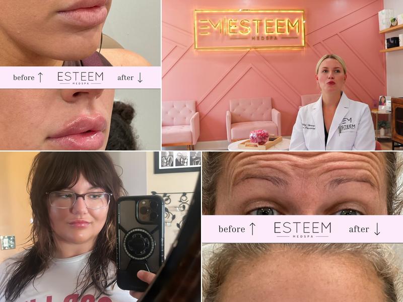 Esteem Medspa