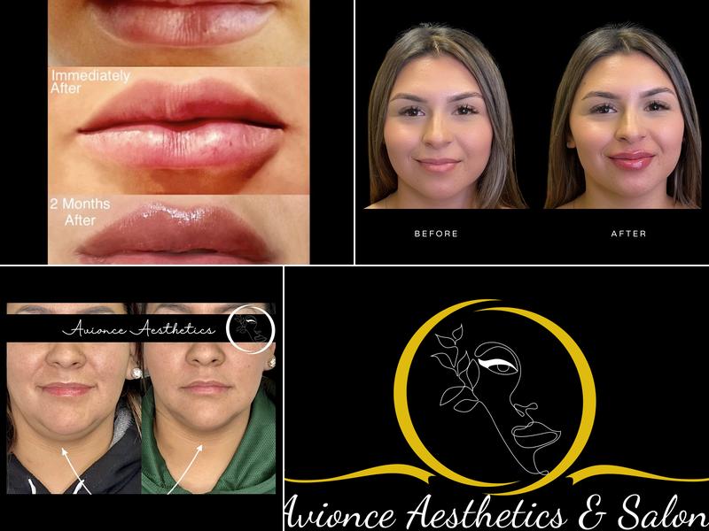 Avionce Aesthetics & Salon