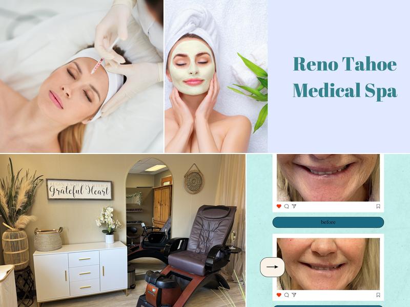 Reno Tahoe Medical Spa
