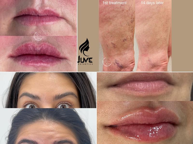 Juves Aesthetics & Cosmetic Procedures