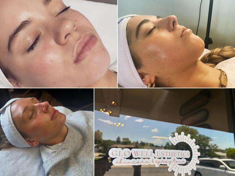 Glo Well Esthetics