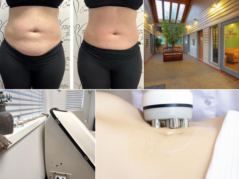 Flatten The Curve Body Sculpting