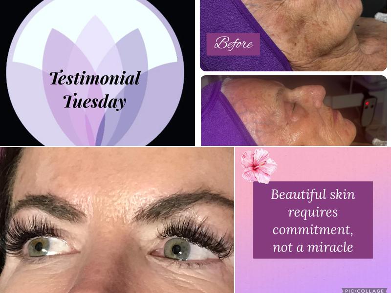 Clifton Park Laser And Wellness