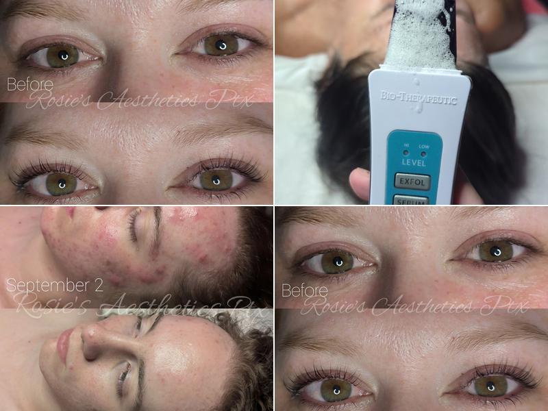 Rosie's Aesthetics PTX