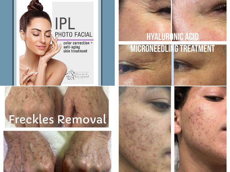 Skincare and Hair Removal by Karin