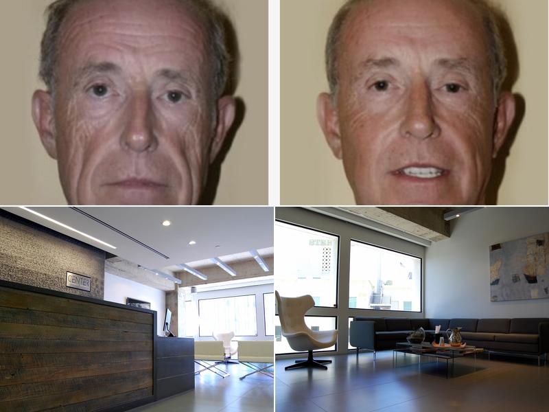 Center For Advanced Facial Plastic Surgery