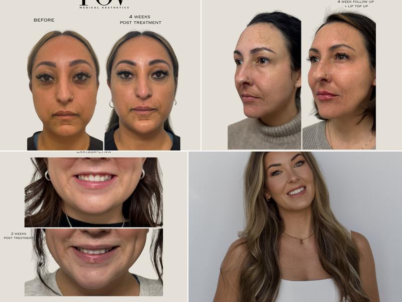 Point of View Medical Aesthetics