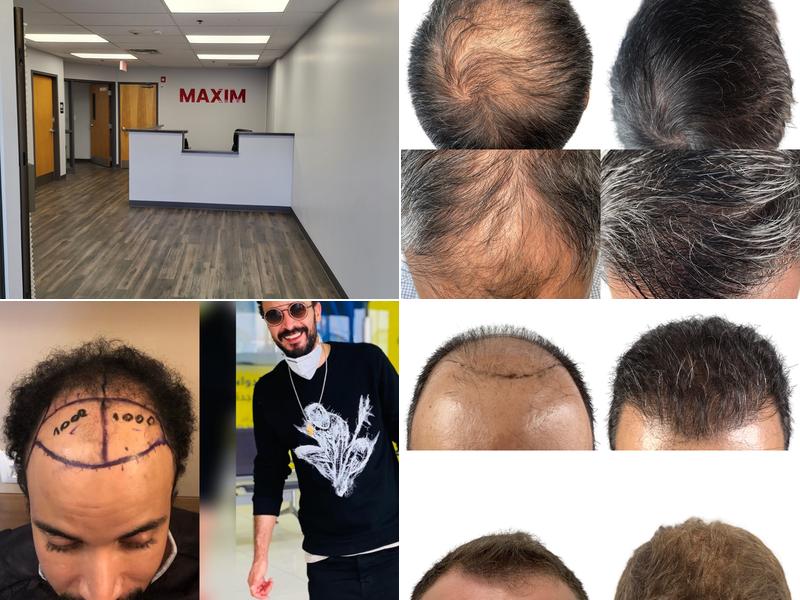 Maxim Hair Restoration & Transplants - Albany