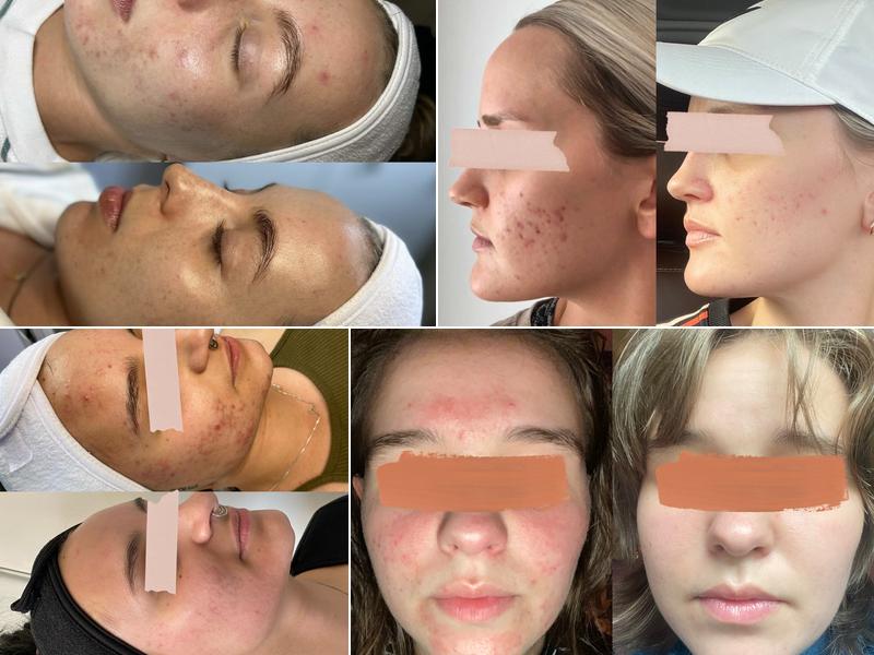 Hapa Advanced Aesthetics