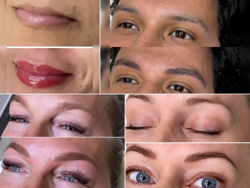 Flawless brow aesthetics