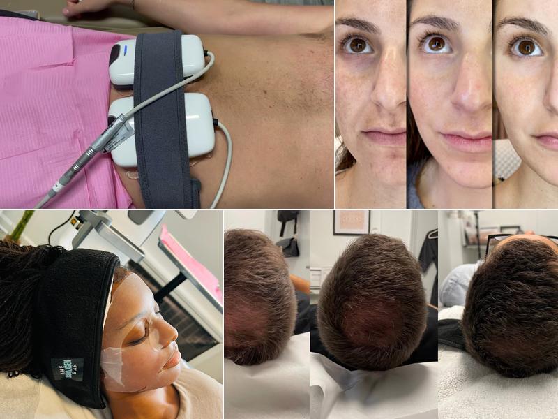 Collagen Bar NYC Microneedling and Body Contouring