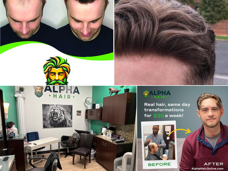 AlphaHair Atlanta - Non Surgical Hair Replacement Solutions