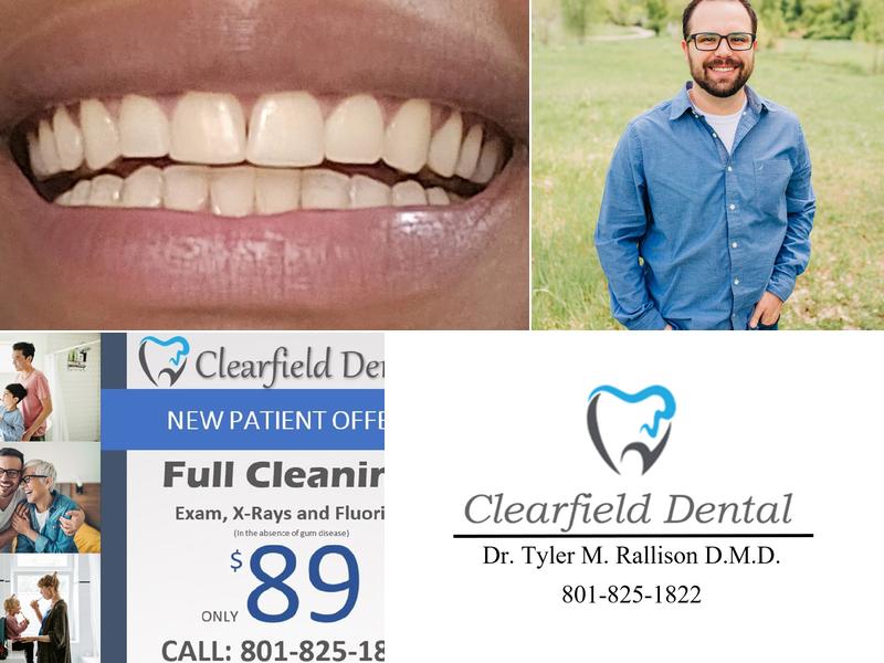 Clearfield Dental - Dr. Tyler M. Rallison DMD