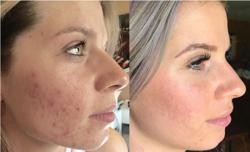 Lisia's Electrolysis & Laser/Body Contouring By Katie