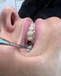 District Dentistry - Dentist Charlotte NC